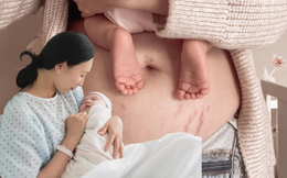 8 món phụ nữ sau sinh nên tích cực ăn để mờ vết rạn, da trắng mịn 