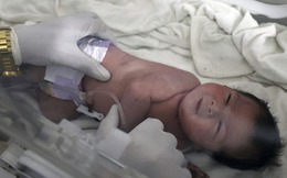 Bé gái Syria chào đời trong đống đổ nát của tòa nhà bị sập, dây rốn vẫn nối với bánh nhau trong bụng mẹ