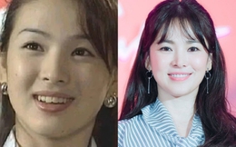 Song Hye Kyo, Lâm Tâm Như thăng hạng nhan sắc nhờ niềng răng