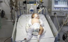 Vụ bé gái 2 tháng tuổi bị bạo hành: Hội LHPN tỉnh Lâm Đồng hỗ trợ gia đình cháu bé