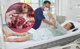 Người đàn ông suy đa tạng nguy kịch sau 3 ngày ăn thịt lợn tự chế biến tại nhà