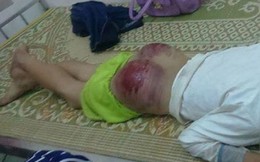 Bố đánh nát mông con vì nghe tin bé ăn cắp