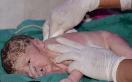Việt Nam đứng thứ 80/184 về tỷ lệ trẻ sơ sinh tử vong