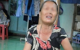 Tâm sự của người vợ suýt chết vì bị chồng giẫm ngang cổ họng 