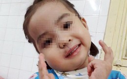 'Giải cứu' bé gái 4 tuổi khỏi u quái vùng mặt