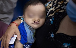 Chạy bộ tiếp sức xuyên Việt gây quỹ phẫu thuật cho trẻ bị dị tật hàm mặt