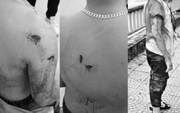 Điều tra vụ học sinh lớp 8 bị bạn dùng vật nhọn đâm rồi hất xuống hồ