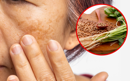 Cách điều trị sạm nám da đơn giản bằng Đông y