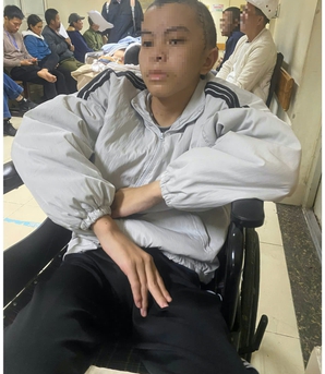 Nam sinh 14 tuổi ở Bắc Ninh bị đánh thương tích 61%