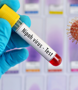 Virus Nipah: Cần giám sát dịch tễ sớm, ngăn chặn nguy cơ lây lan trong cộng đồng
