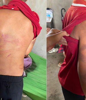 Nghệ An: Mẹ tố cha ruột bạo hành con trai 10 tuổi