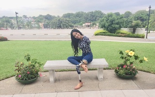 “Nữ chiến binh’’ mất 2 tay và 1 chân