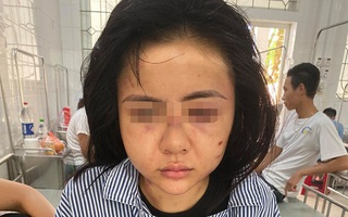 Hội LHPN tỉnh Yên Bái nói gì về vụ cô gái bị gã đàn ông xăm trổ đánh đập suốt 2 tiếng?