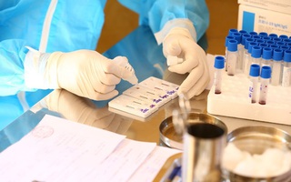 Tính đến 2/8, cả nước đã thực hiện hơn 482.000 xét nghiệm Realtime PCR