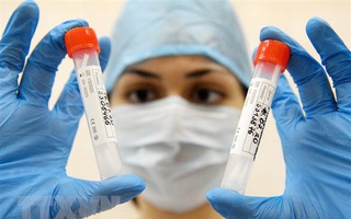 5 dự án vaccine lớn được kỳ vọng đẩy lùi dịch Covid-19