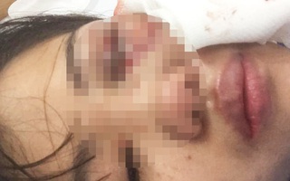 Nữ nhân viên hãng taxi "tố" bị chồng bạo hành dã man