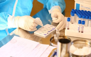 TP.HCM: 8 bệnh viện có đủ năng lực xét nghiệm khẳng định virus SARS-CoV-2 