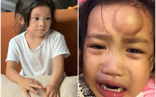 Con gái Hải Băng bị cào rách mặt vì ẩu đả, con Ốc Thanh Vân tai nạn còn xót hơn