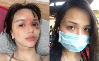 Trước siêu mẫu Khả Trang, nhiều sao nữ cũng từng bị bạo hành đến "thân tàn ma dại"