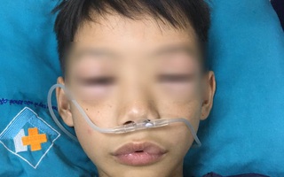 Uống thuốc tự mua, bé 10 tuổi ở Phú Thọ bị sốc phản vệ phải cấp cứu