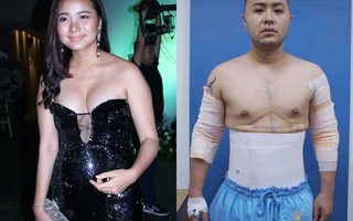 Sao Việt đột ngột "phát tướng", lộ bụng mỡ: Người nhanh chóng đi phẫu thuật, người mặc kệ dư luận