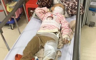 Sạt lở đất trong đêm, 2 cháu nhỏ bị thương phải nhập viện