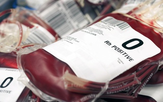 Nghiên cứu hơn 600.000 người: Người nhóm máu O sống thọ nhất, nhóm máu A dễ bị đột quỵ hơn