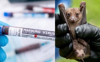 Virus Marburg khiến WHO tuyên bố cảnh báo đợt bùng phát mới là gì?
