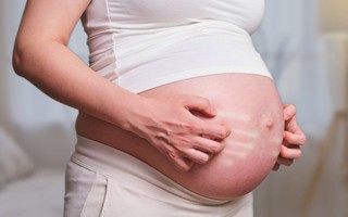 Bà bầu bị ngứa bụng, bác sĩ cảnh báo những nguy hiểm cho cả mẹ và thai nhi