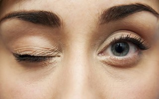 Nhiều người làm động tác này để giảm mỏi mắt mà không biết có thể gây biến dạng nhãn cầu