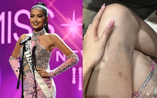 Ngọc Châu lộ đôi chân bầm tím ở Miss Universe 2022
