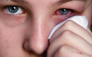 Nhiễm trùng ổ mắt vì biến chứng viêm xoang