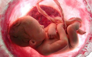 Dây rốn quấn 2 vòng quanh cổ thai nhi, 1 thói quen khi mang thai của người mẹ là "thủ phạm"
