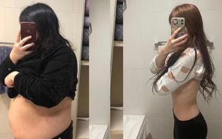 Cô gái Hàn Quốc giảm 75kg chia sẻ tác hại từ giảm cân tiêu cực