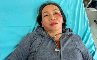 Nữ nạn nhân vụ tai nạn ở Quảng Nam bàng hoàng kể lại khoảnh khắc thoát chết 