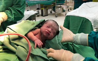 Bác sĩ sản giải đáp cách để mẹ sinh thường mà không phải khâu cắt tầng sinh môn