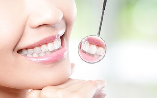 3 màu sắc ở răng là dấu hiệu cảnh báo căn bệnh dẫn đến rụng răng, thậm chí ung thư