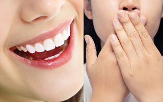 Giải pháp ngăn chặn hôi miệng do bọc răng sứ