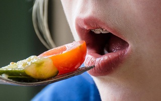 5 nhóm thực phẩm trẻ cần tránh trong 24-48 giờ sau khi đeo niềng răng