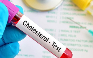 Cứ 10 người Việt trưởng thành thì có 3 người thừa cholesterol vì 1 nguyên nhân 