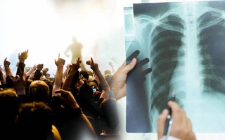 Thanh niên vỡ phế nang vì la hét trong concert của thần tượng: Nguyên nhân nào dẫn đến tràn khí màng phổi?