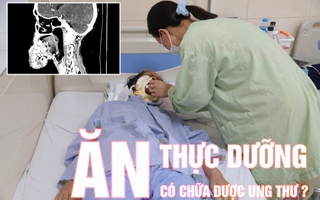 Người phụ nữ có khối u di căn từ môi xuống hàm: Bác sĩ nói về lời đồn "ăn thực dưỡng chữa ung thư"