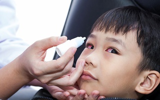 Dịch đau mắt đỏ vào mùa, bé có 5 dấu hiệu sau cha mẹ cần cho con đi khám ngay