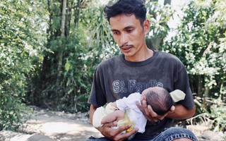 Xót cảnh bé trai 1 tháng tuổi không có hậu môn, cha mẹ nghèo không tiền cứu chữa