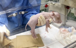 Nhật Bản tạo giống lợn có nội tạng phù hợp cho 
cấy ghép