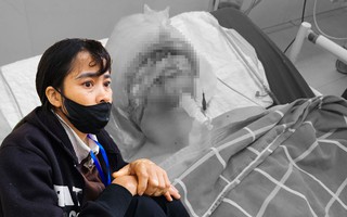 Vụ tai nạn giao thông ở Tuyên Quang: 15 ngày trắng đêm cùng con “chiến đấu” với tử thần
