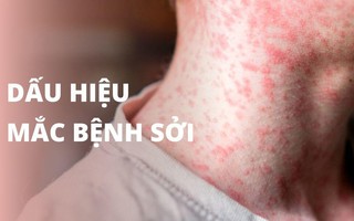 Những điều cần biết về bệnh sởi