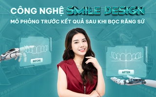 Thiết kế nụ cười độc bản bằng công nghệ Smile Design tại Nha khoa Thiên Hà