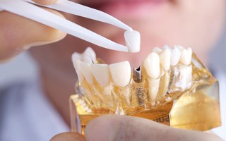 Nuôi cấy thành công "răng người" trong miệng lợn
