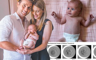 Em bé đầu tiên chào đời bằng kỹ thuật IVF tự động